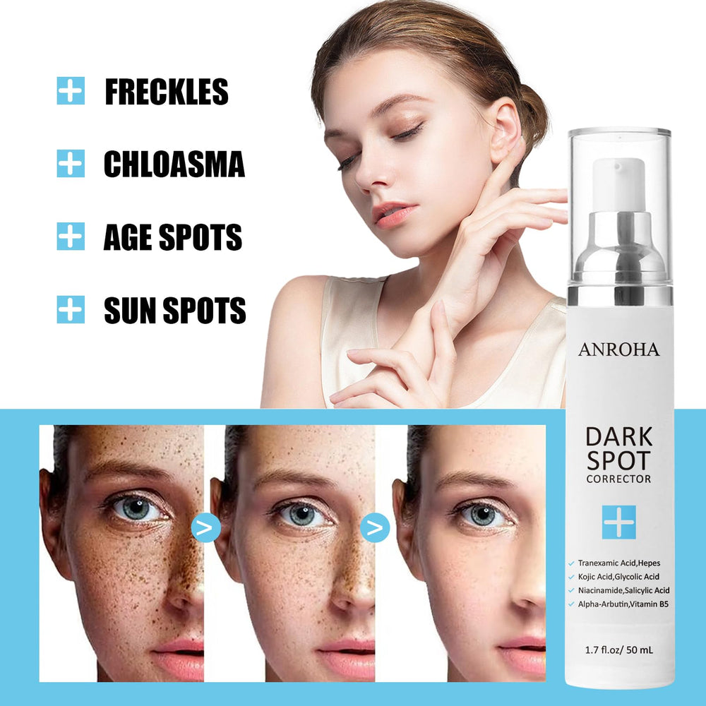 Anroha Dark Spot Remover closeup texture reveals a lightweight, fast absorbing serum.