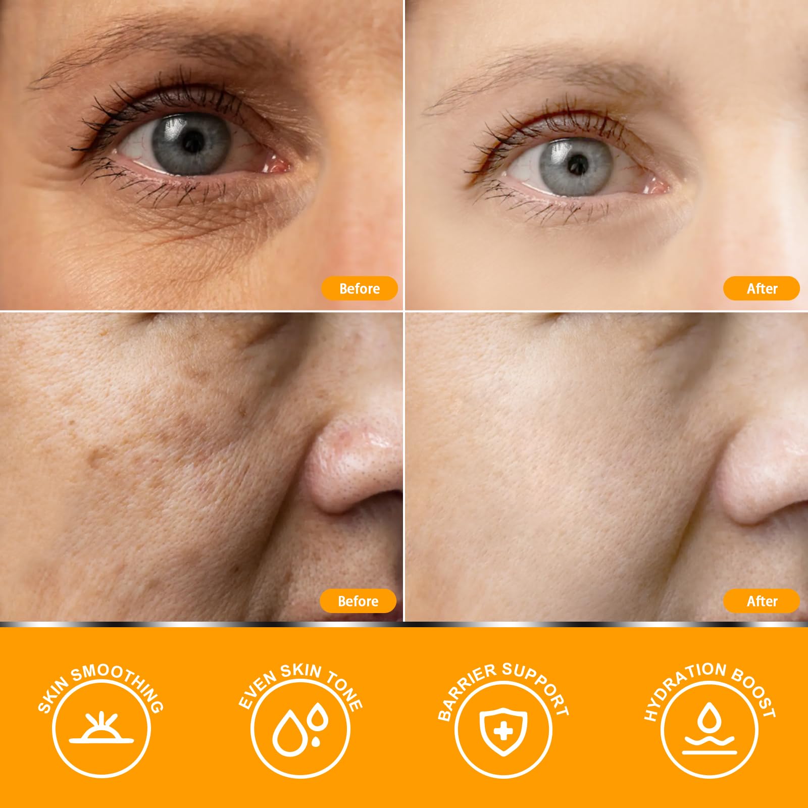 Anroha Vitamin C Serum for mature skin delivers smoother texture.