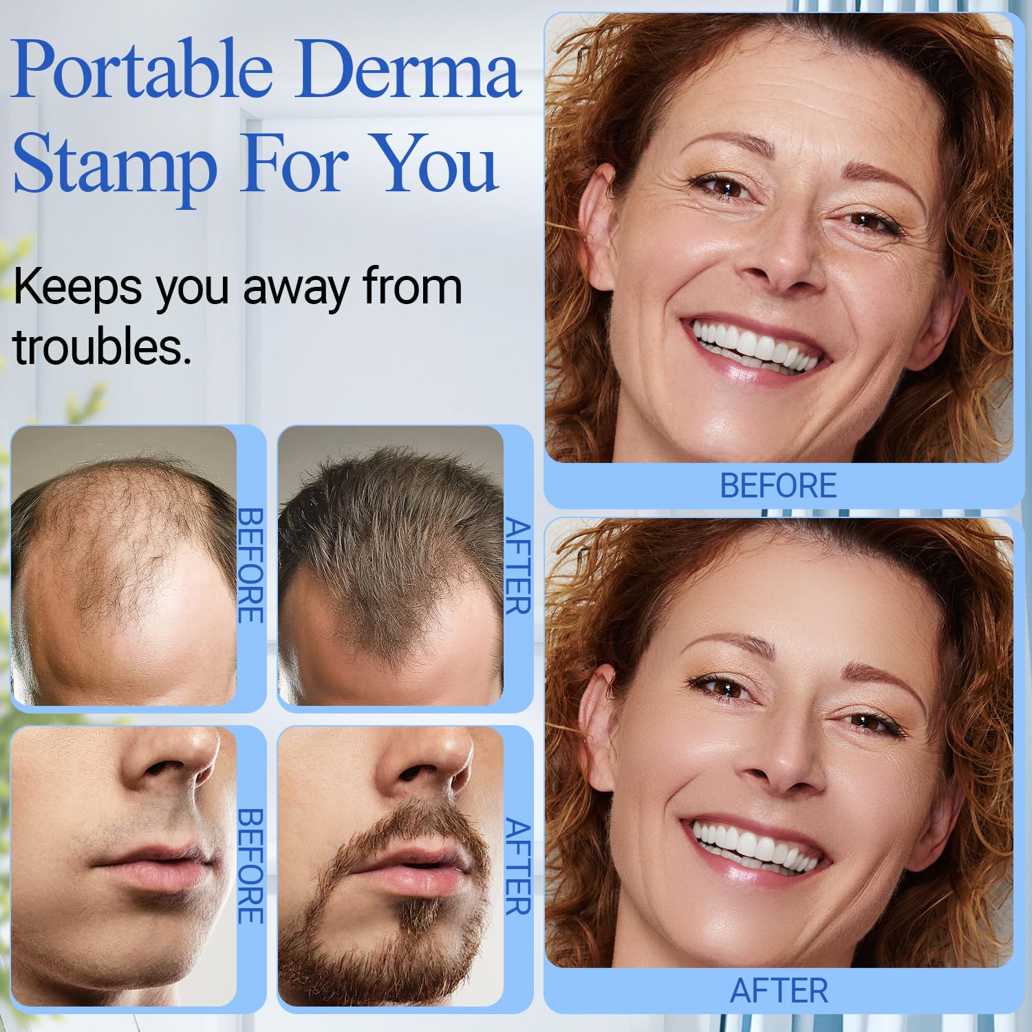 ANSIOVON Derma Stamp compact travel case for on-the-go skincare routines.