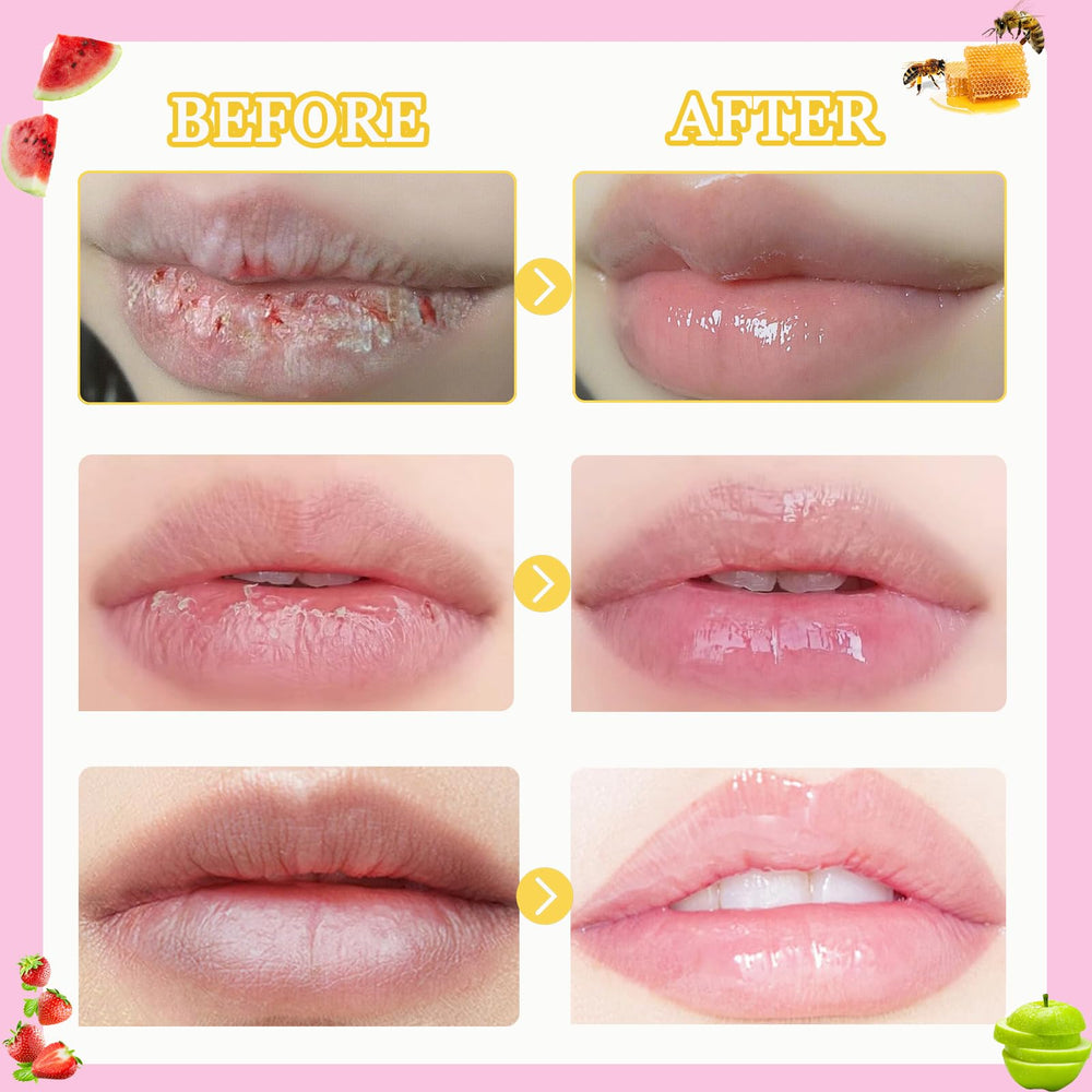 Anweina Bee Lip Balm cherry pot for fruity lip nourishment