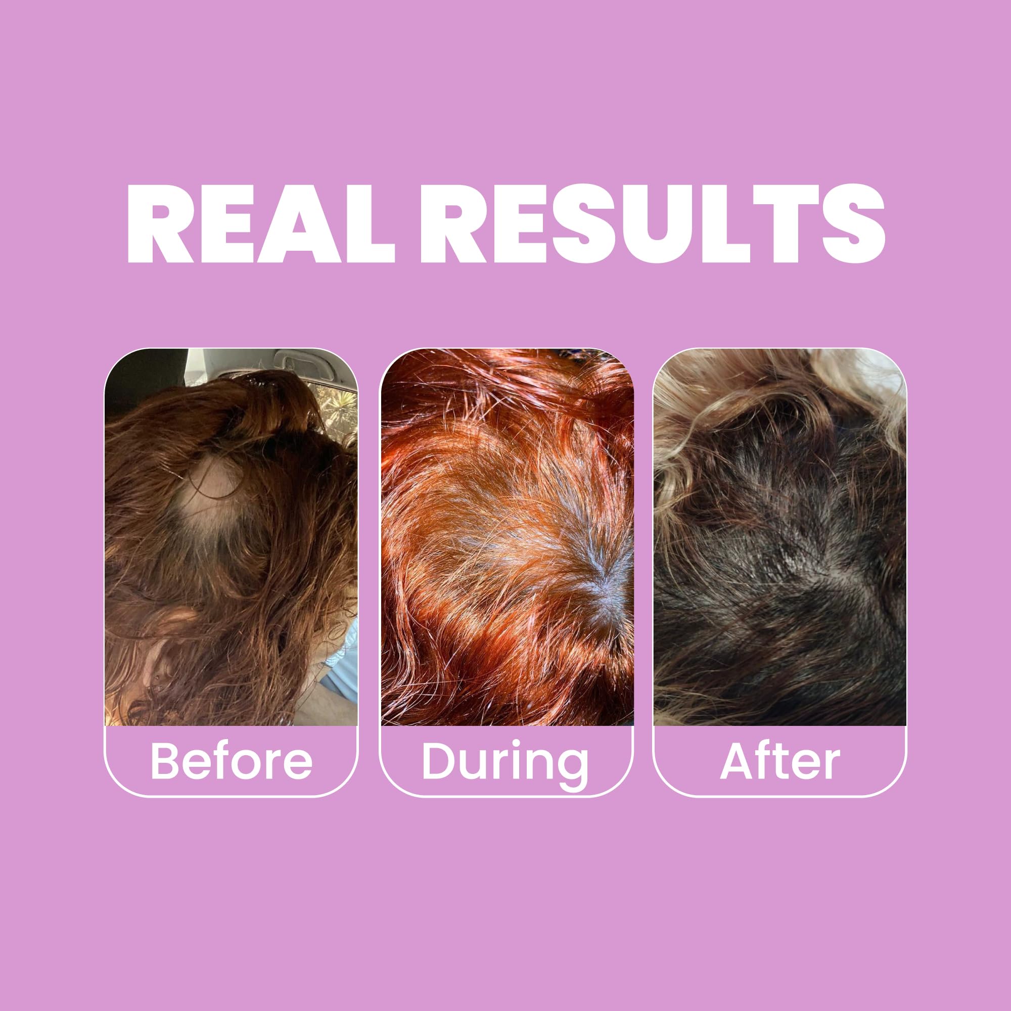Anyeluz Onion Conditioner ingredients close-up with biotin