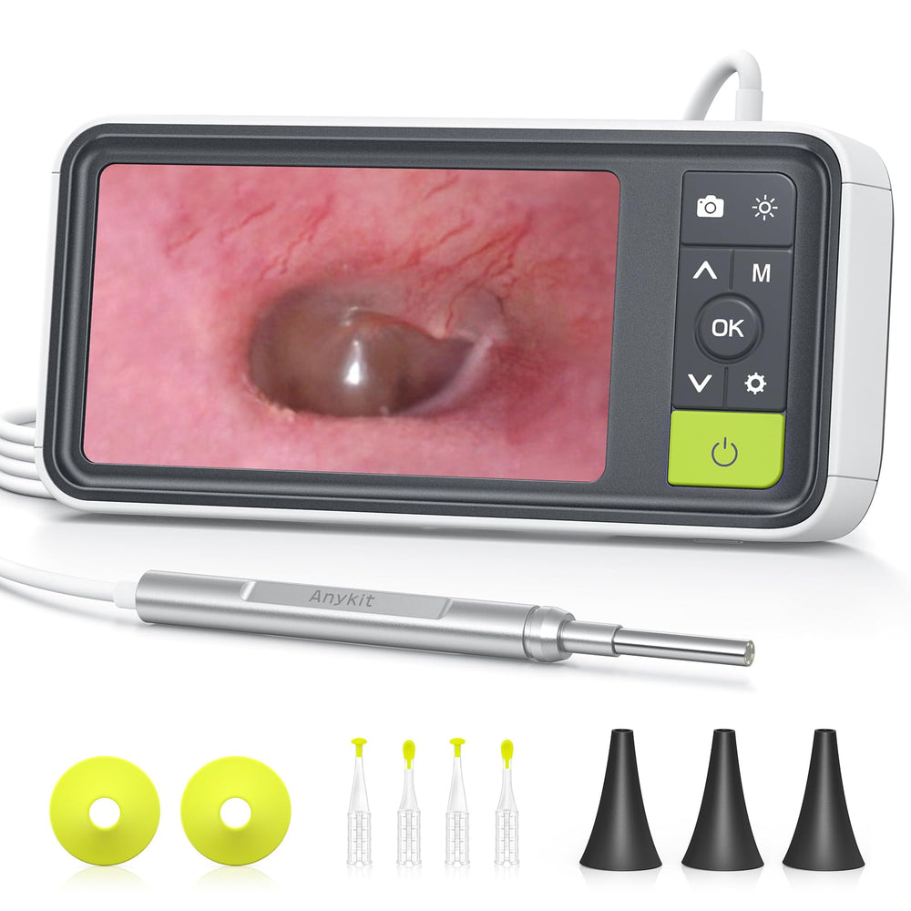 Anykit otoscope gyroscope view for stable, clear ear canal images.