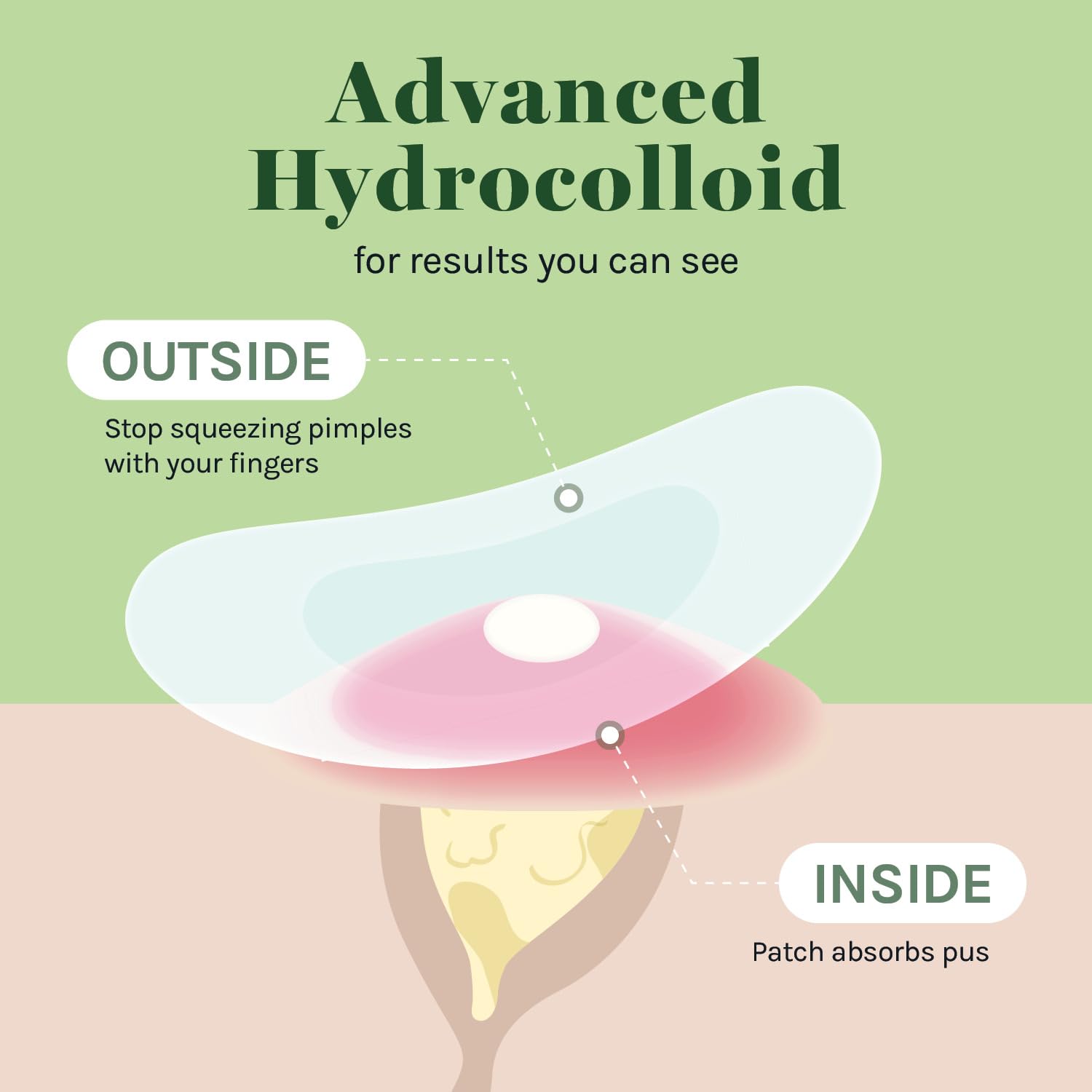 AOA Studio hydrocolloid patch 12mm close-up highlighting two size option.