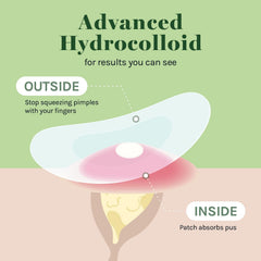 AOA Studio hydrocolloid patch 12mm close-up highlighting two size option.
