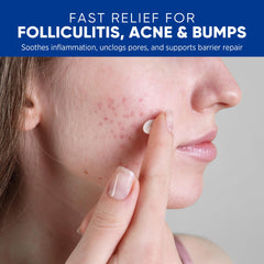 AOSORW Folliculitis Cream texture highlights lightweight, non-greasy absorption.