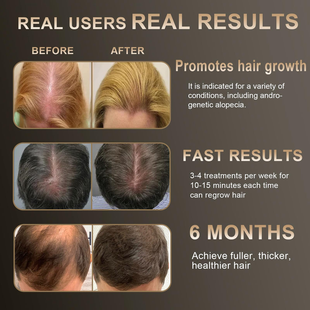 Apbier Laser Hair Growth Comb in use on scalp for potential growth support.