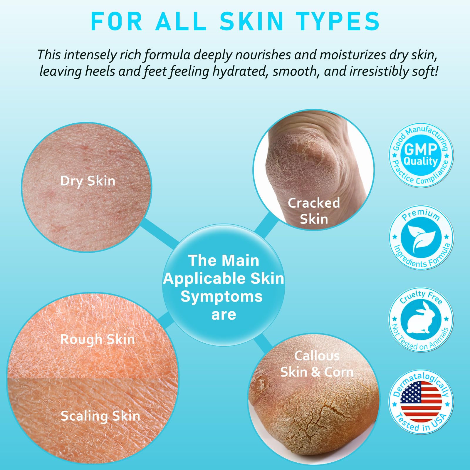 Aphesia Urea Cream 40% elbow and knee care for rough skin.