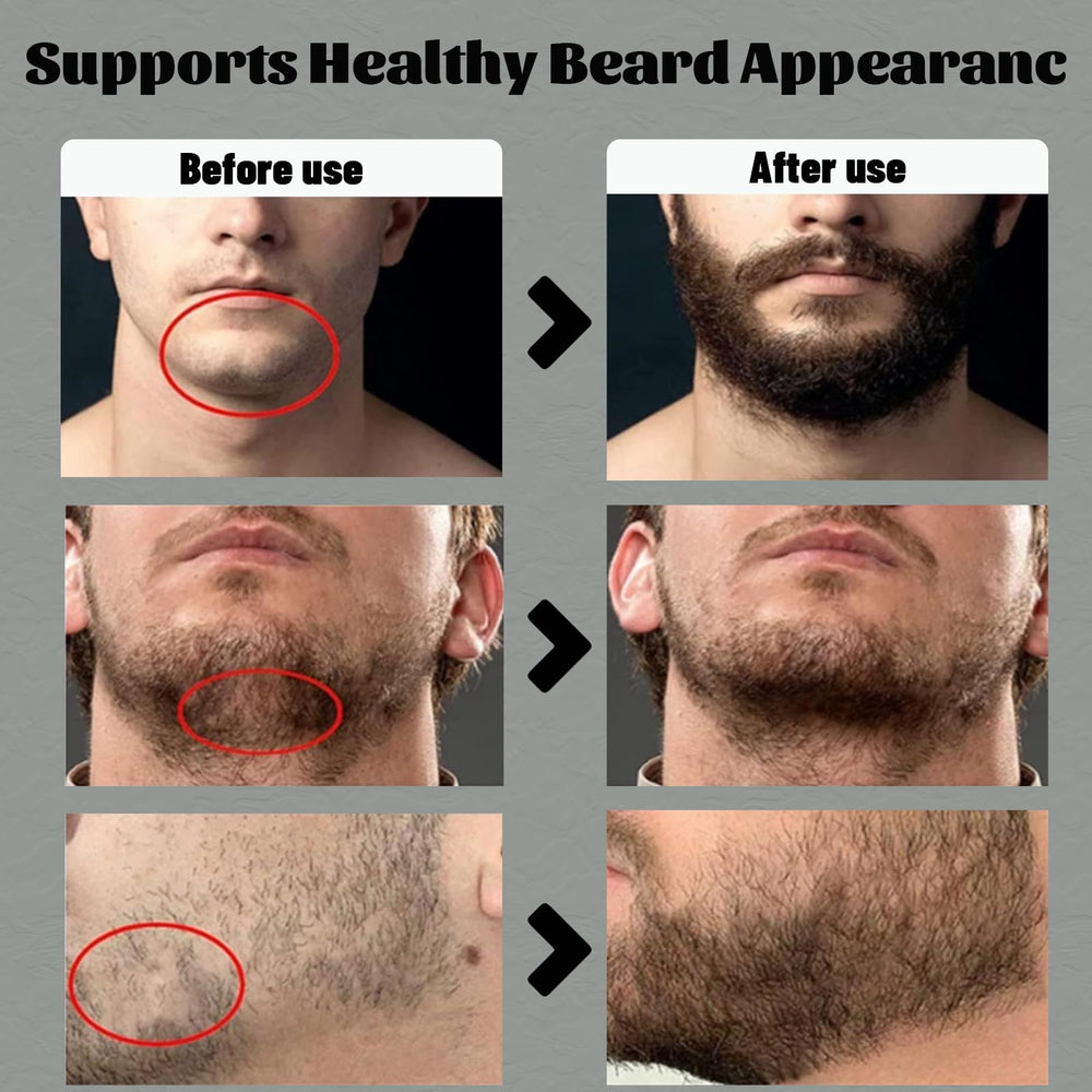 Apolo Cosmetics beard-care-skin-nourishing demonstrates nourishing formula for beard and skin.