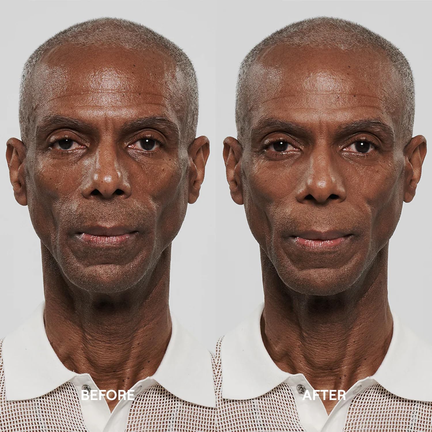 APOSTLE Reclaim blemish coverage swatch indicates redness reduction.