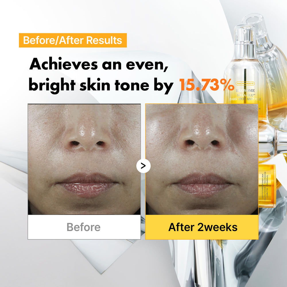 APOTHE Exosome Mela-Glu niacinamide arbutin formula on label brightening potential