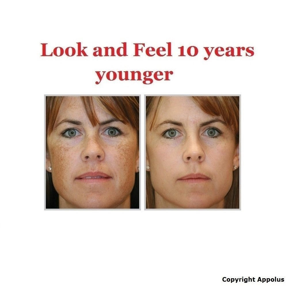 Appolus Microdermabrasion Charging Base for cordless use