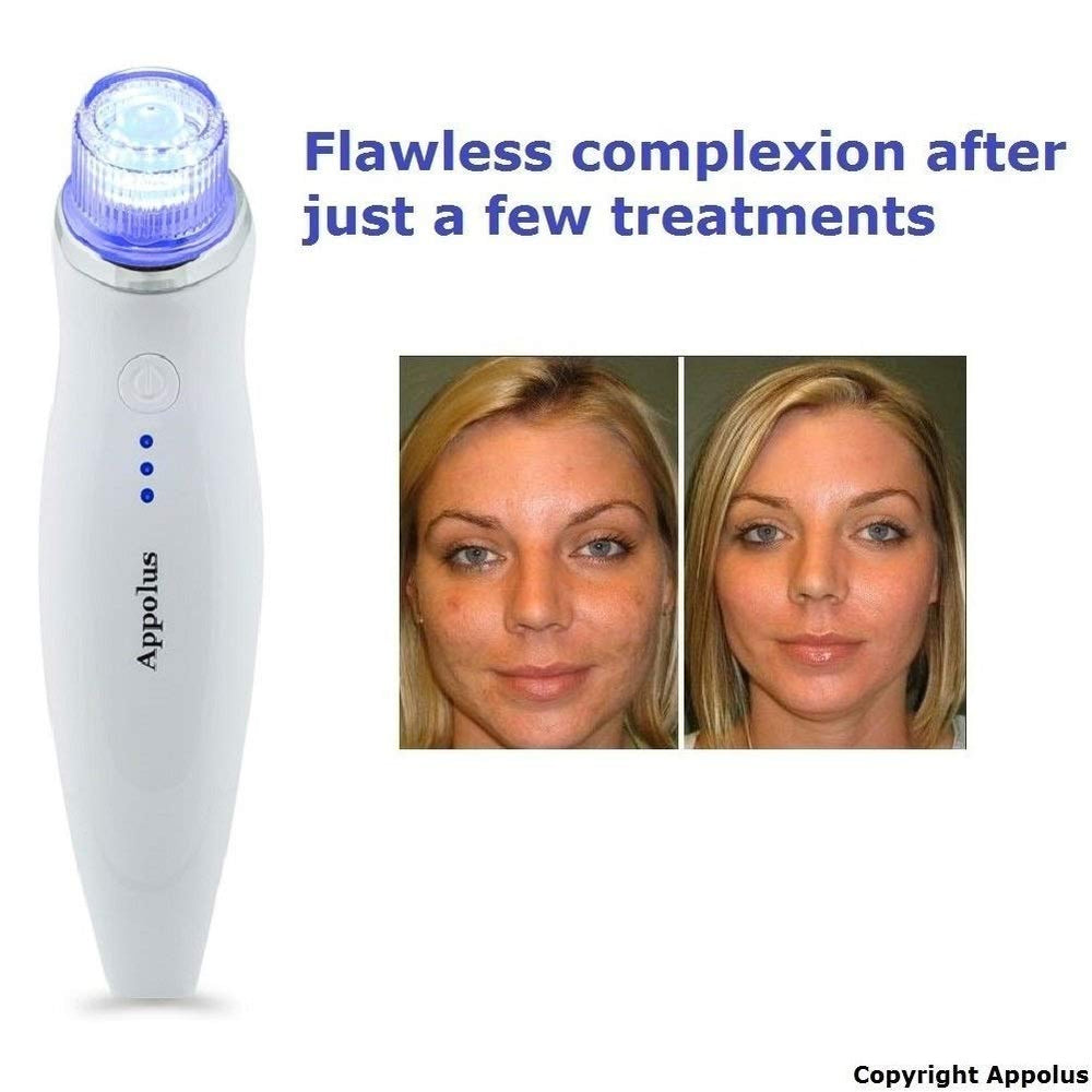 Appolus Microdermabrasion Vacuum-Tip Large for broader treatment