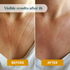 APRICOT Decollete Pad used for a 15–20 minute treatment session.