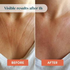 APRICOT décolleté-tightening effect after wear on the chest area.