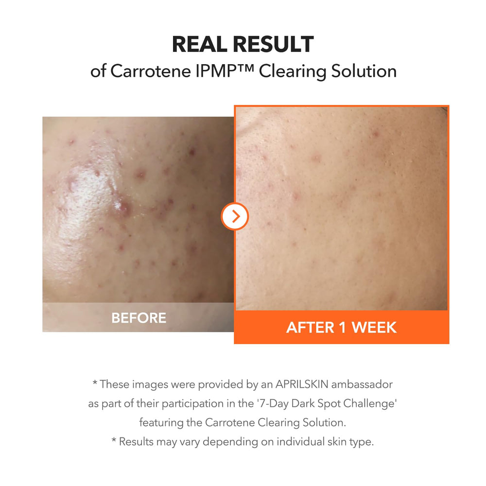 APRILSKIN Carrotene IPMP Clearing Solution after cleansing scene, easy addition to routine.