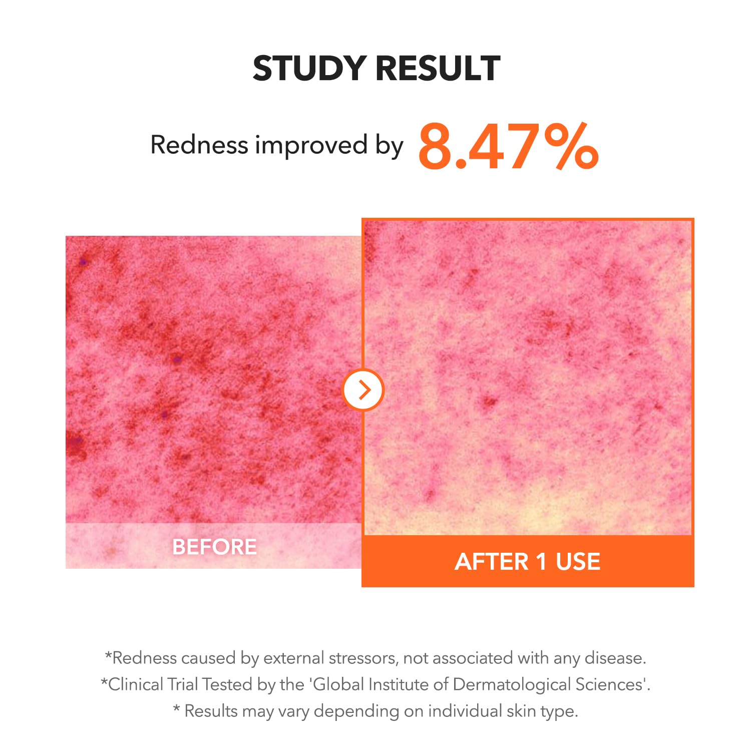 APRILSKIN Carrotene IPMP Clearing Solution ingredients zinc oxide, supports skin recovery and reduced redness.