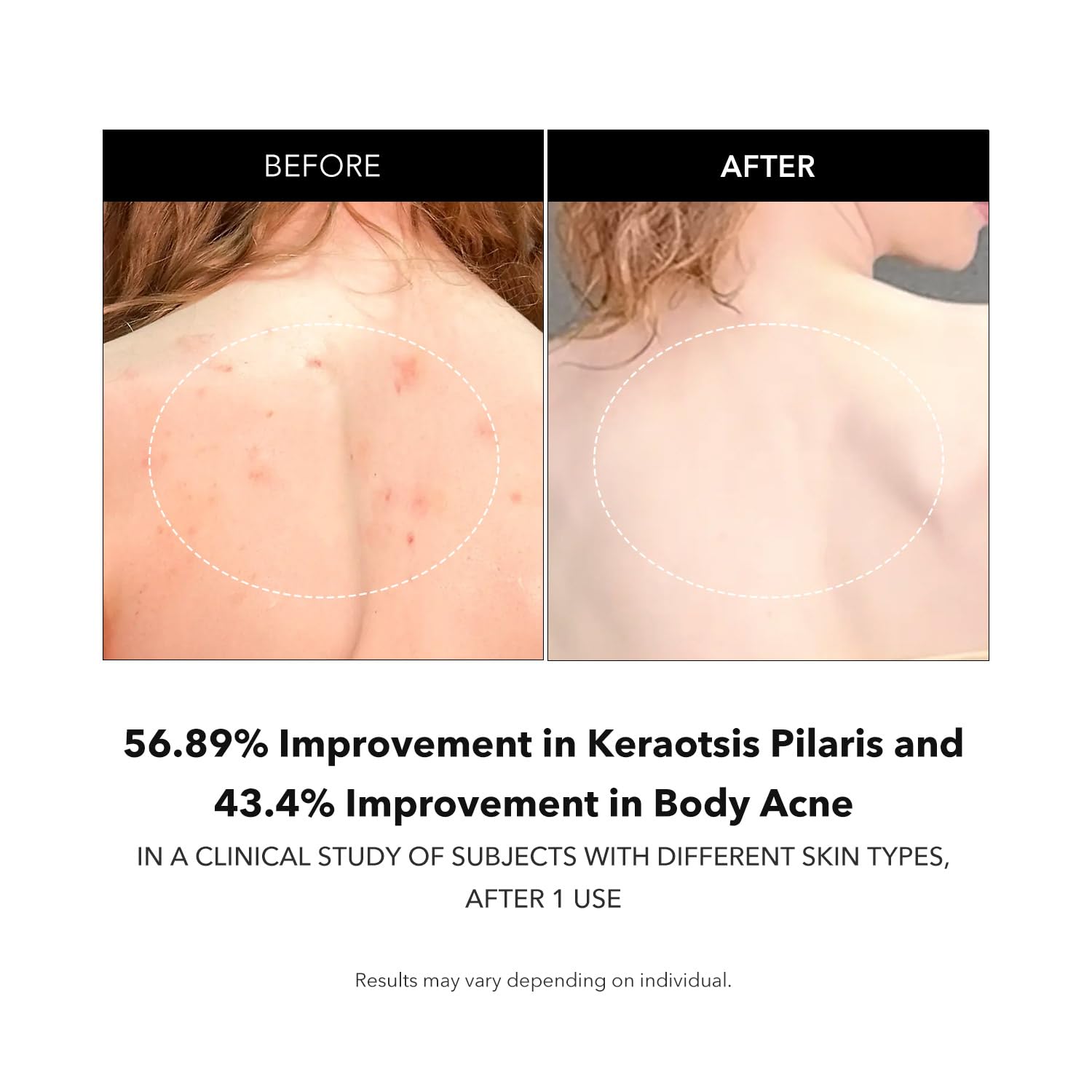 APRILSKIN Carrotene IPMP exfoliating body wash exfoliation action smooths surface texture over time.