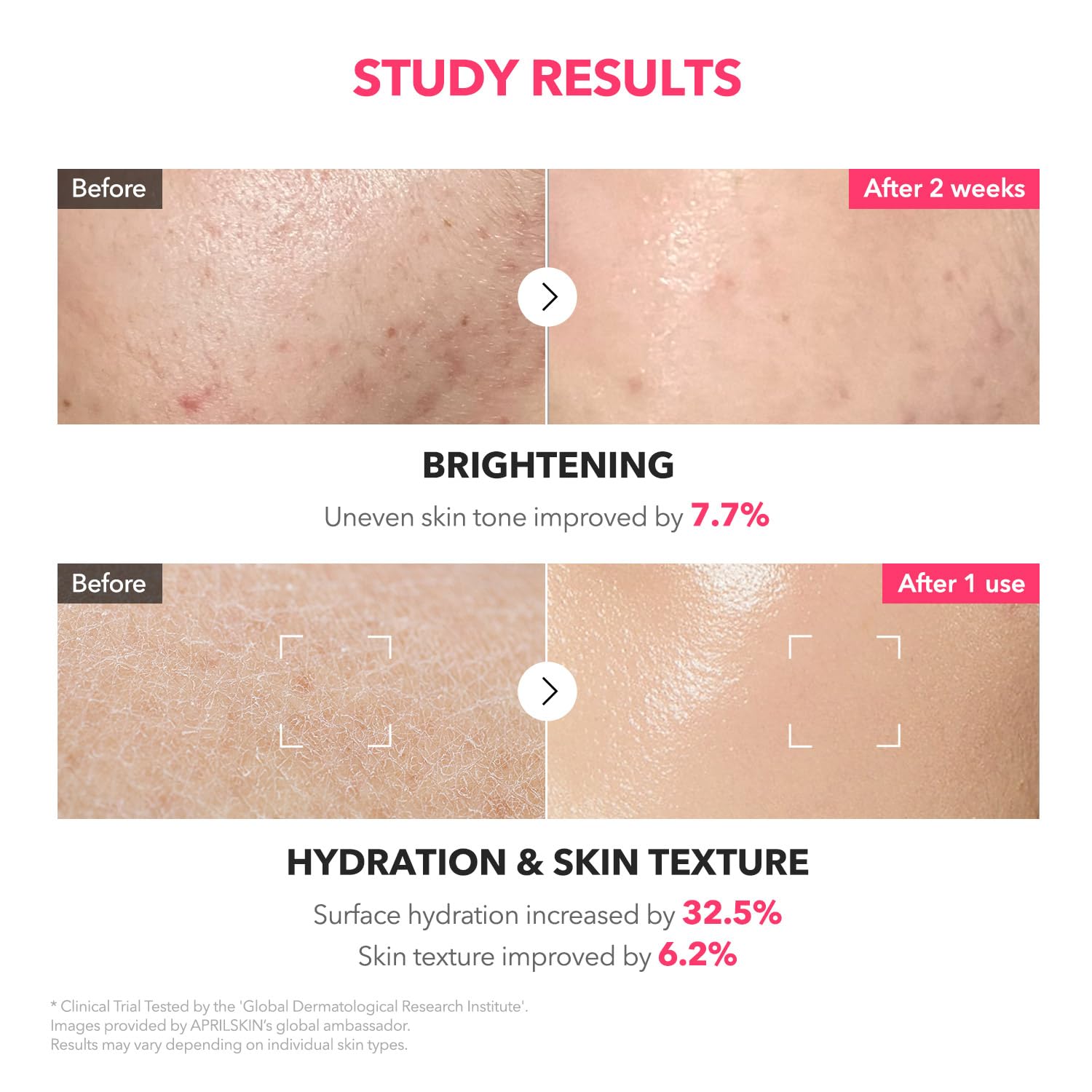 Ceramides and panthenol in APRILSKIN formula support comfort and resilience