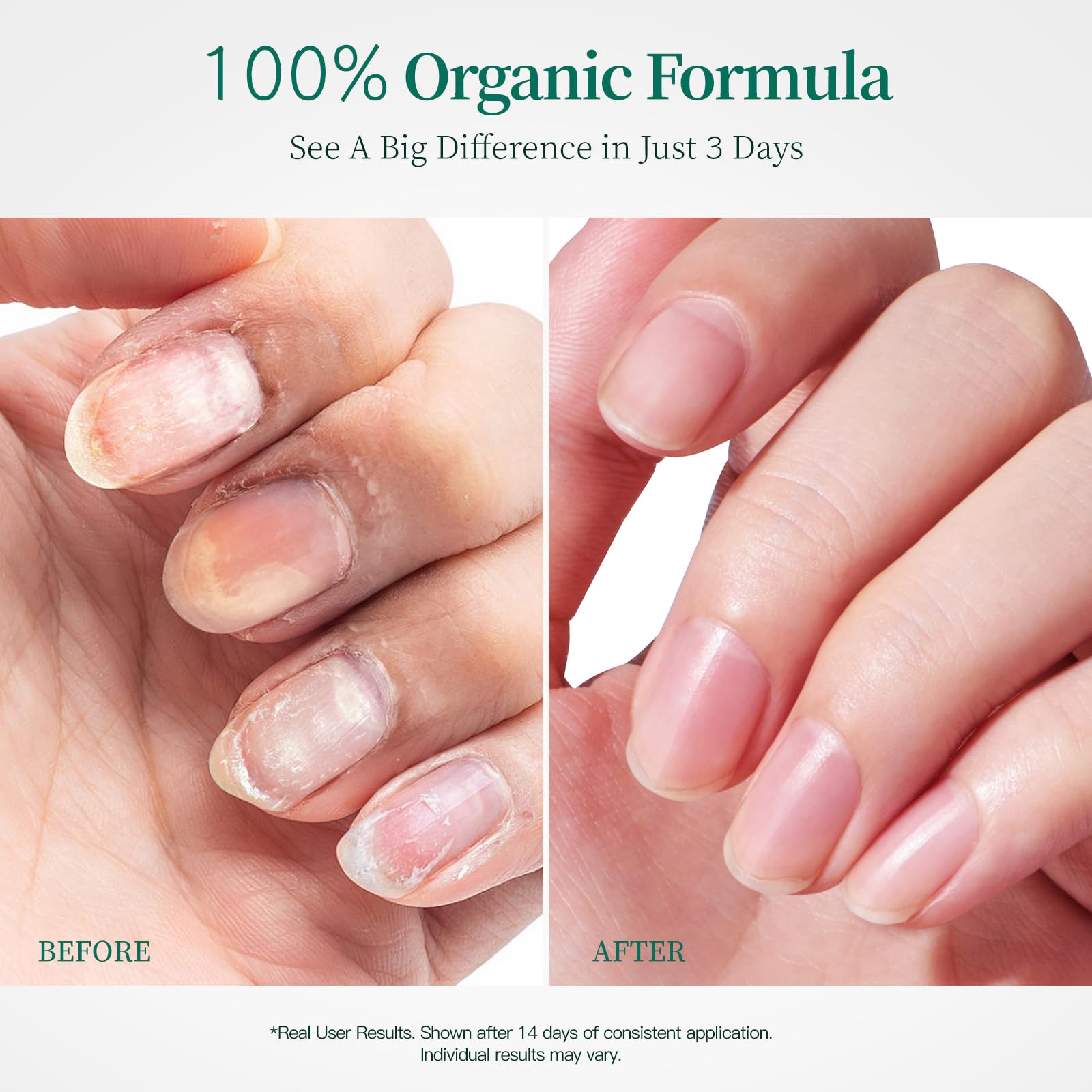 APUREE cuticle oil bottle drops applying smoothly for deep hydration