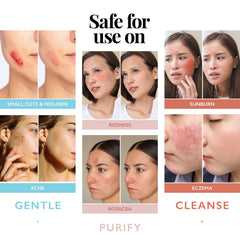 Aquia hypochlorous spray for eczema or irritated skin aftercare.