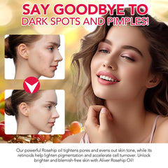 ar-bcrn rosehip oil night application absorbs quickly for overnight moisture.