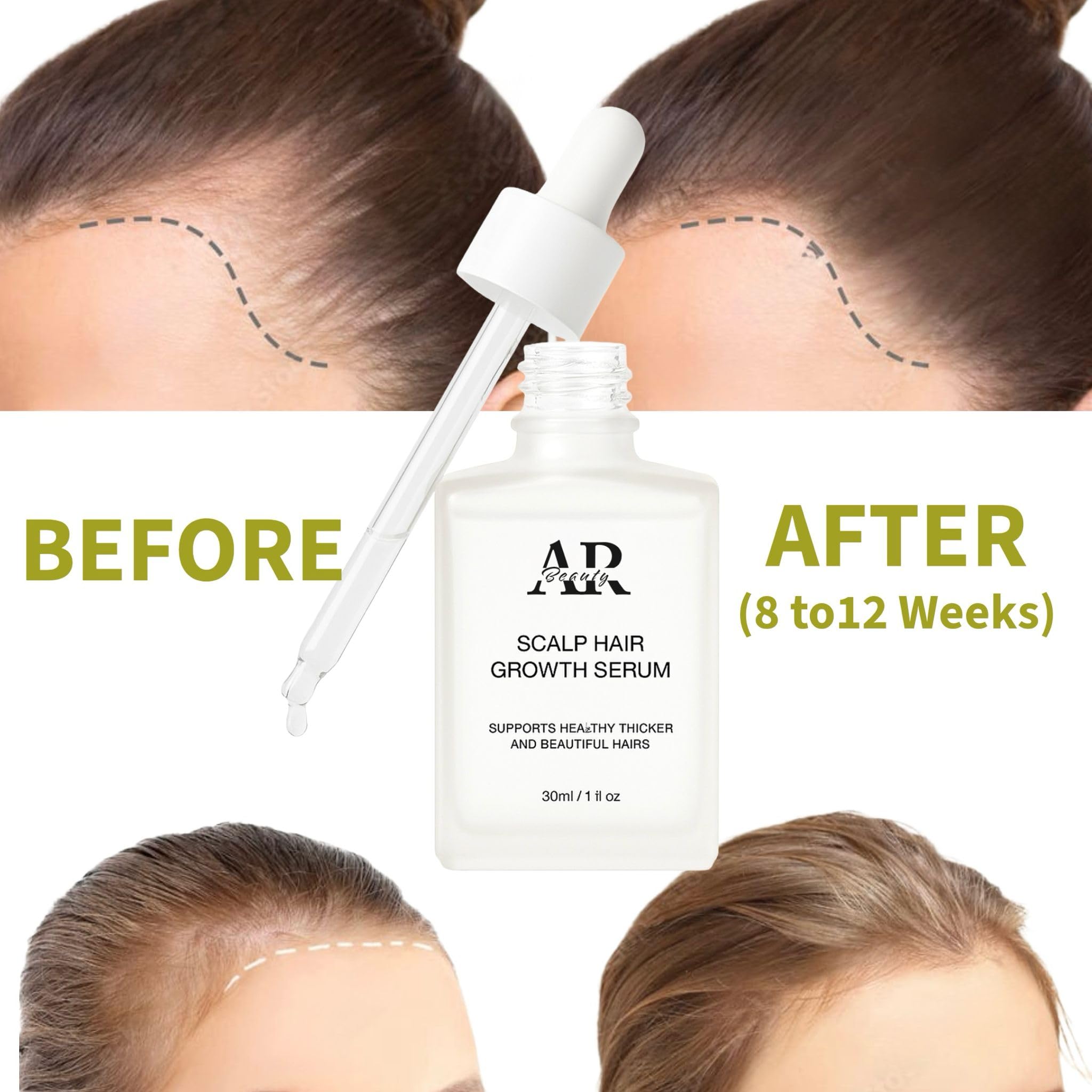 ARBEAUTY Scalp Hair Growth Serum daily routine with serum on bathroom shelf