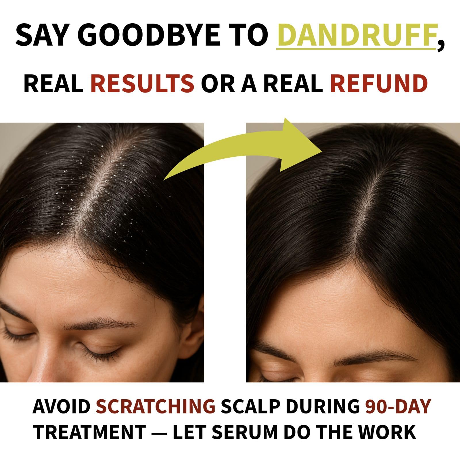 ARBEAUTY Scalp Hair Growth Serum ingredient close-up featuring rosemary and biotin