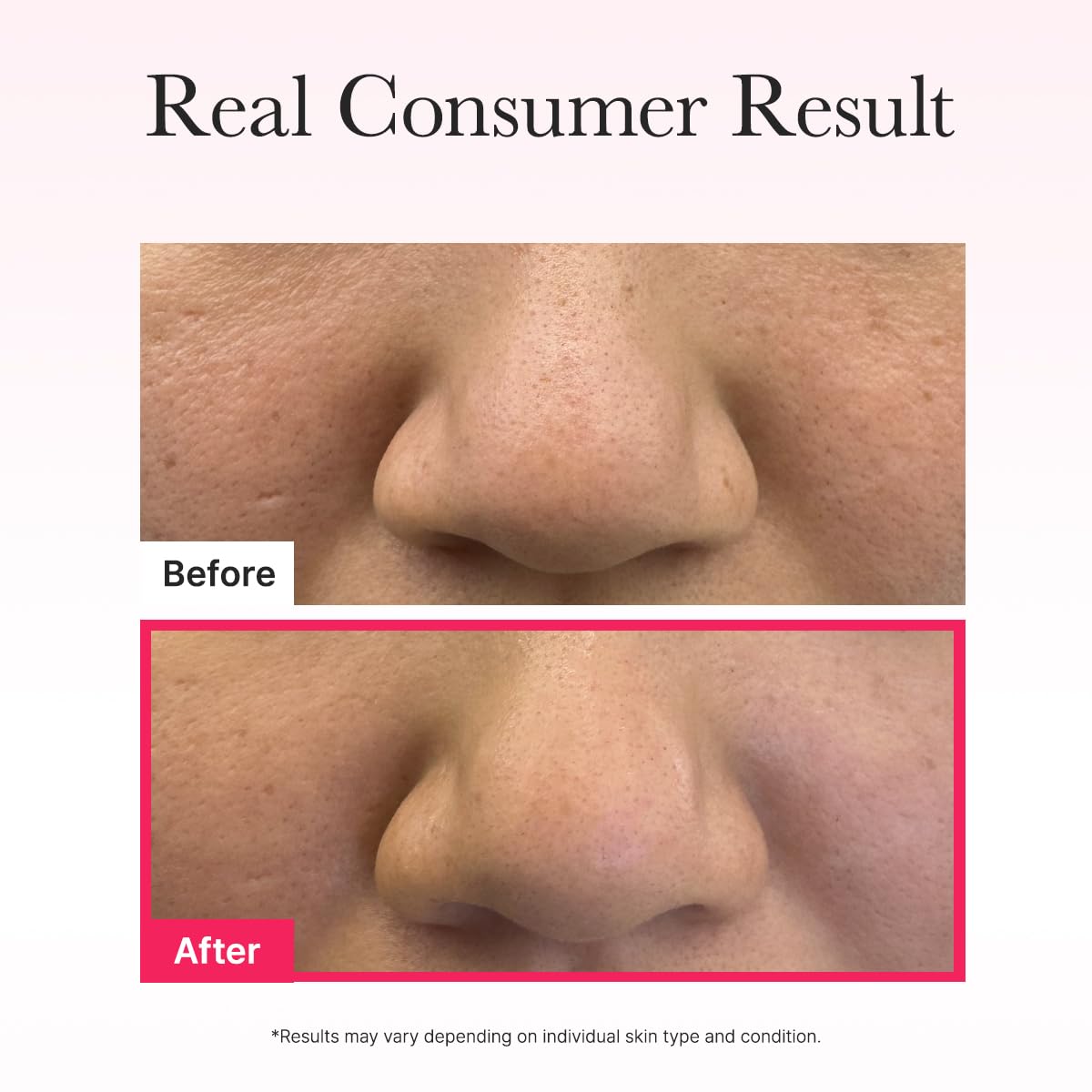 ARENCIA Red Collagen Jello Mask on skin to show plump, hydrated appearance.