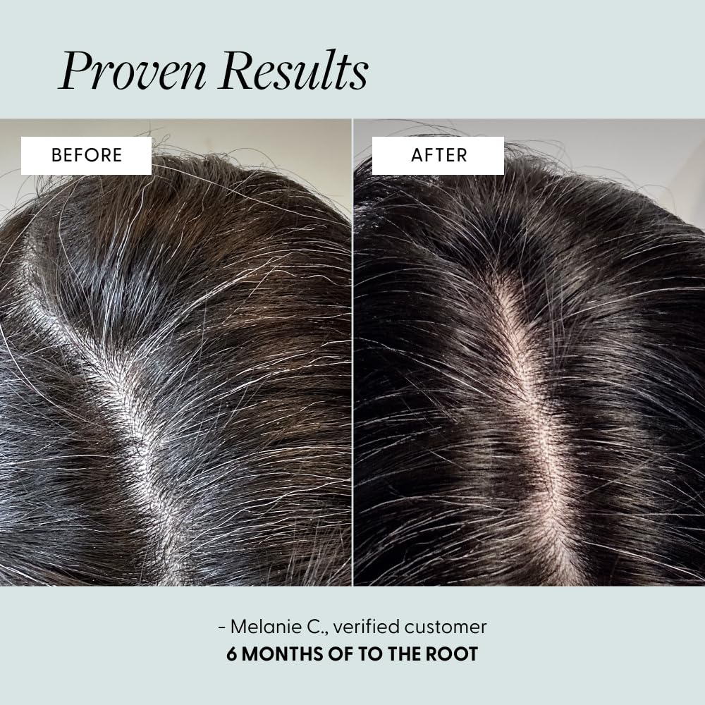 Hands applying Arey To The Root Serum to the scalp for targeted nourishment.