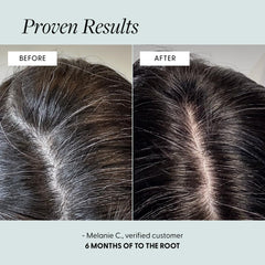 Hands applying Arey To The Root Serum to the scalp for targeted nourishment.