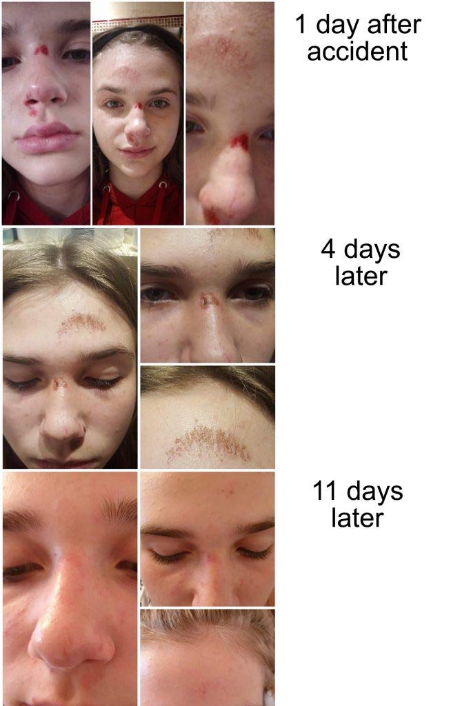 Application routine shot demonstrates clean fingertips applying drops