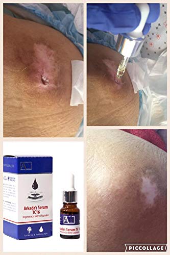 Close-up glow on skin after applying ARKADA serum