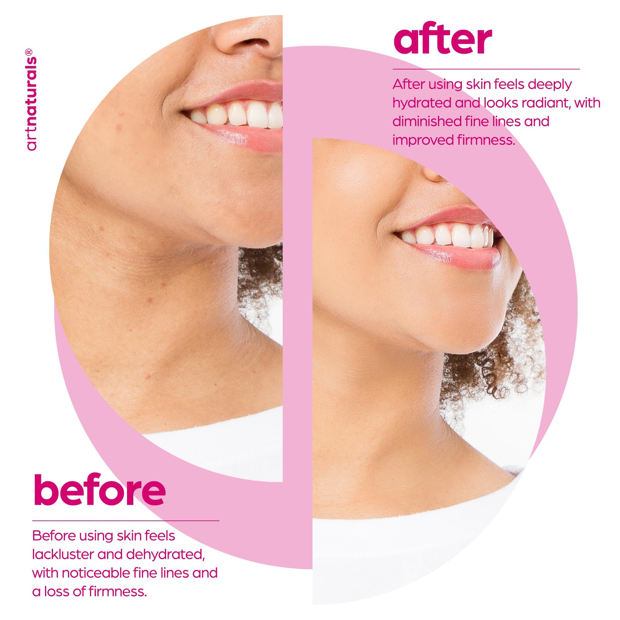 Artnaturals Collagen Booster Serum texture on skin promotes even tone.