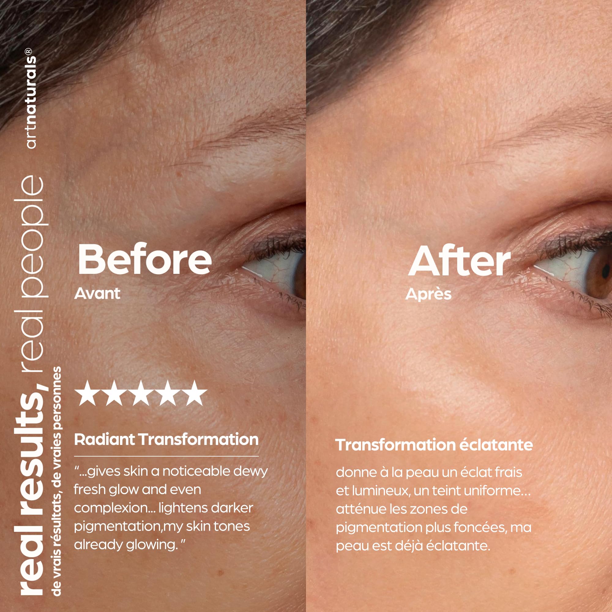 ArtNaturals Hyaluronic Acid Serum on a vanity complements daily skincare routine.