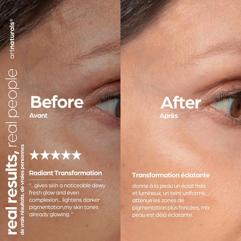 ArtNaturals Hyaluronic Acid Serum on a vanity complements daily skincare routine.