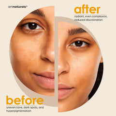 Artnaturals turmeric-infused formula promotes moisture balance and glow