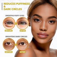 Arvesa rose oil and vitamin C eye patches nourish the delicate skin.