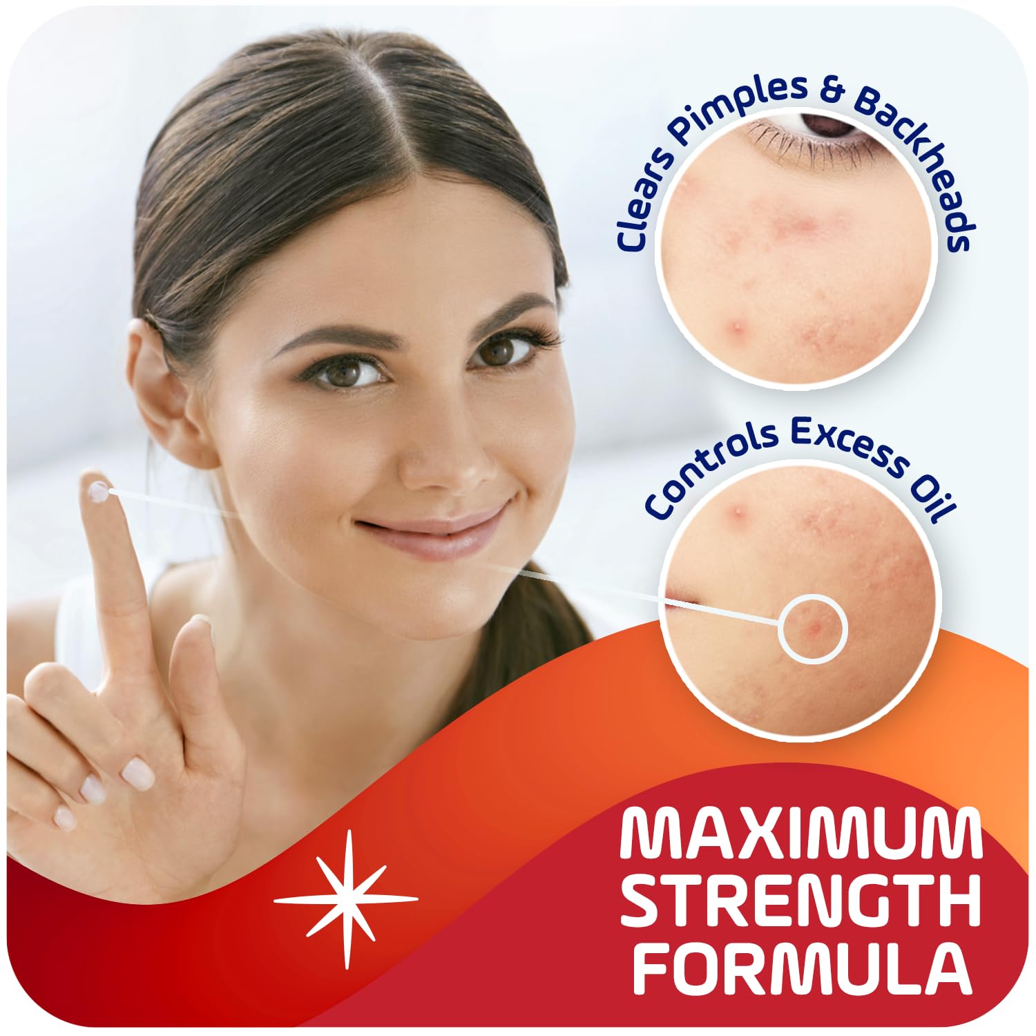 Applying Asepxia cream to a pimple for rapid, gentle relief.