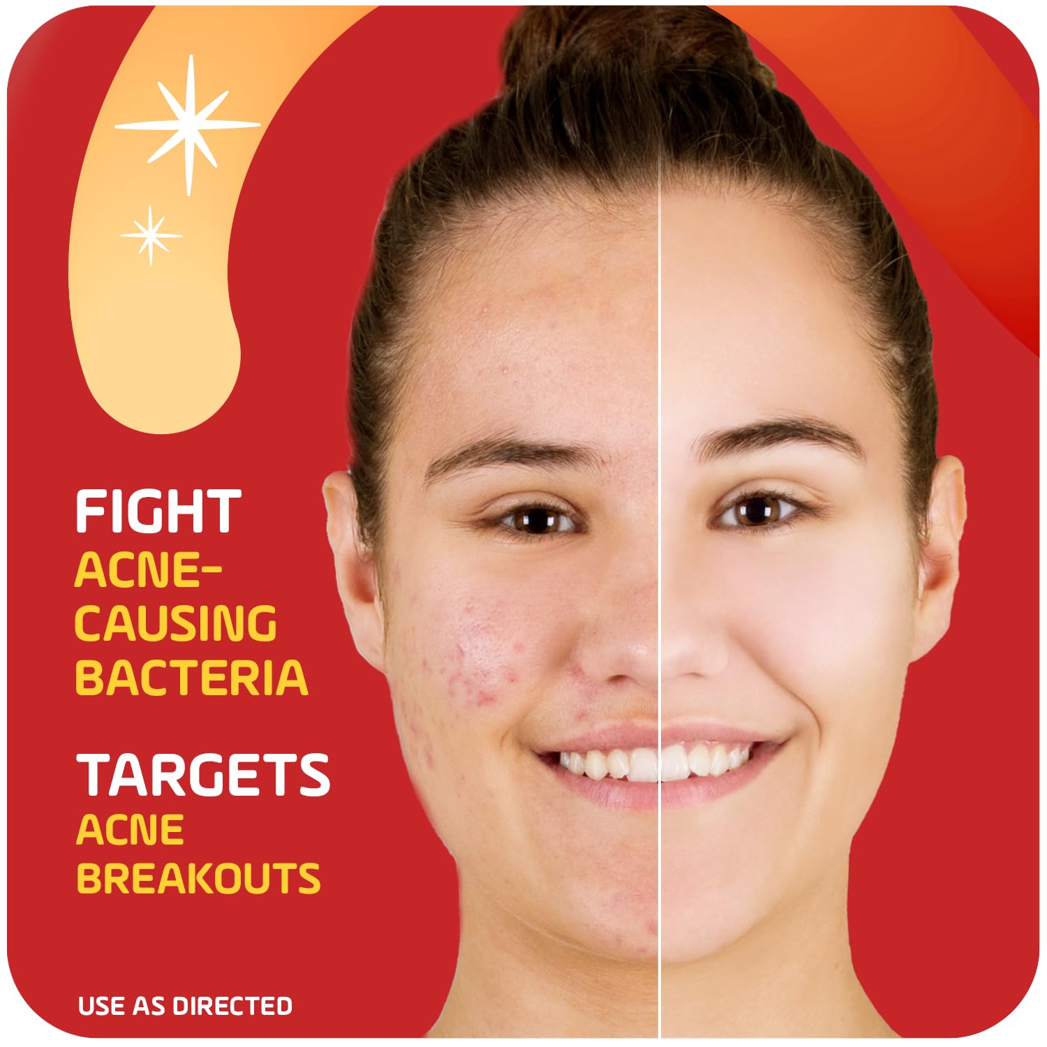Asepxia tube highlighting the drying formula for quick skin clear-up.
