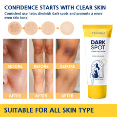 Ashania Inner thigh dark spot treatment demonstrates targeted use.