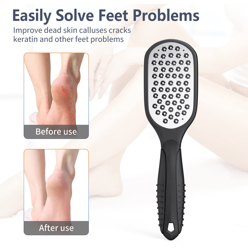 AsonTao Foot Rasp in use on dry feet for callus reduction