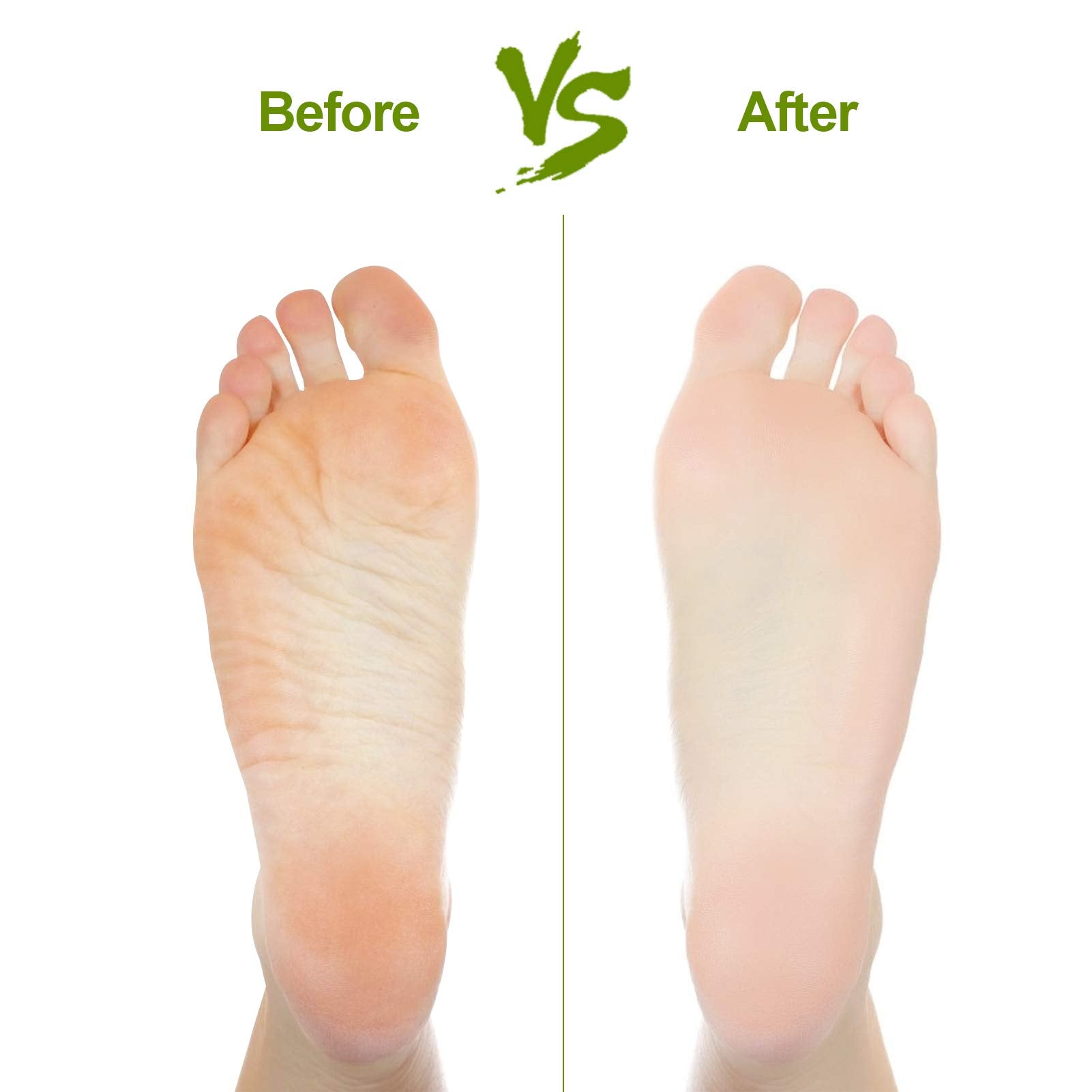 Asqraqo hand and foot care tool for smoother skin.