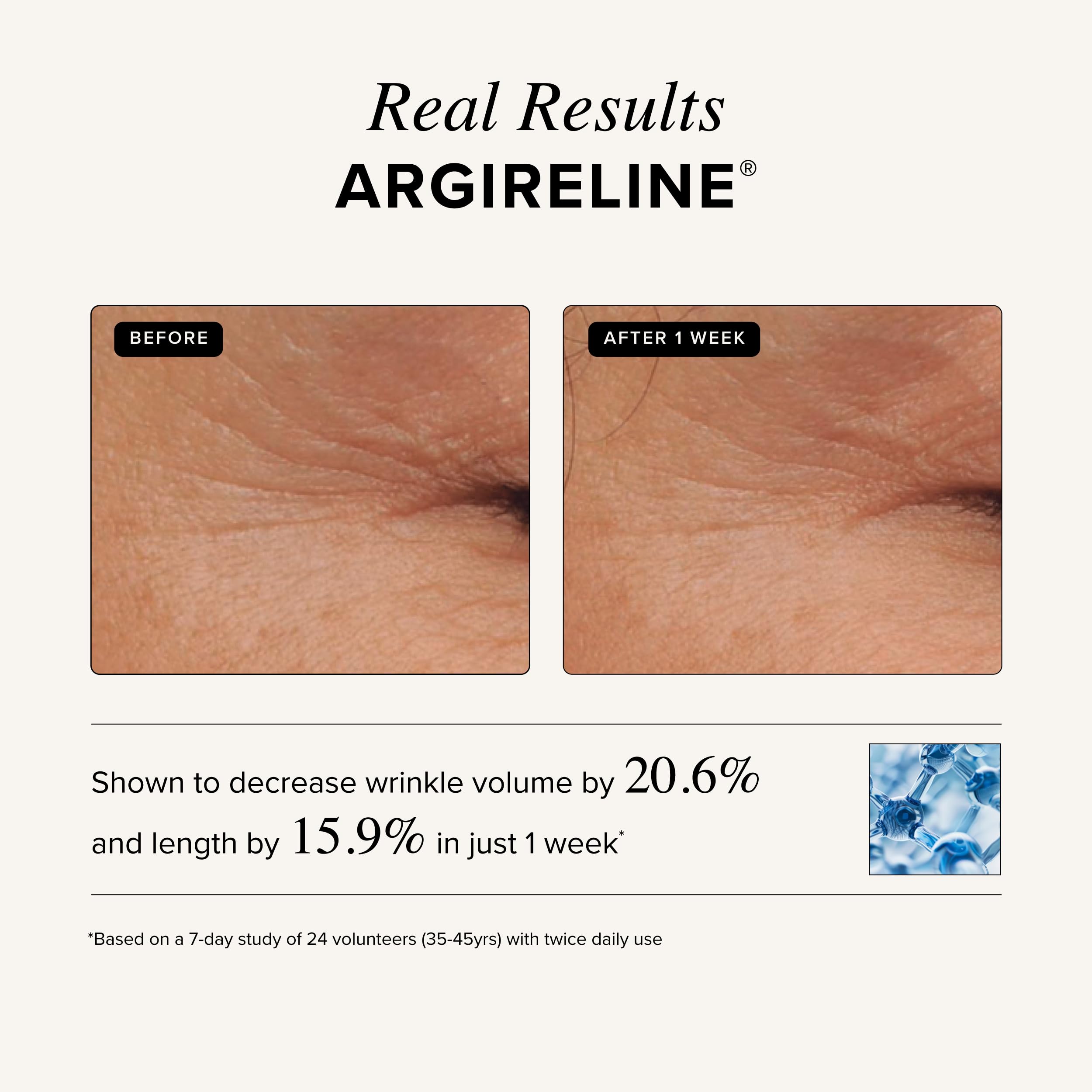 Asterwood night skincare routine scene suggests overnight hydration and renewing benefits.