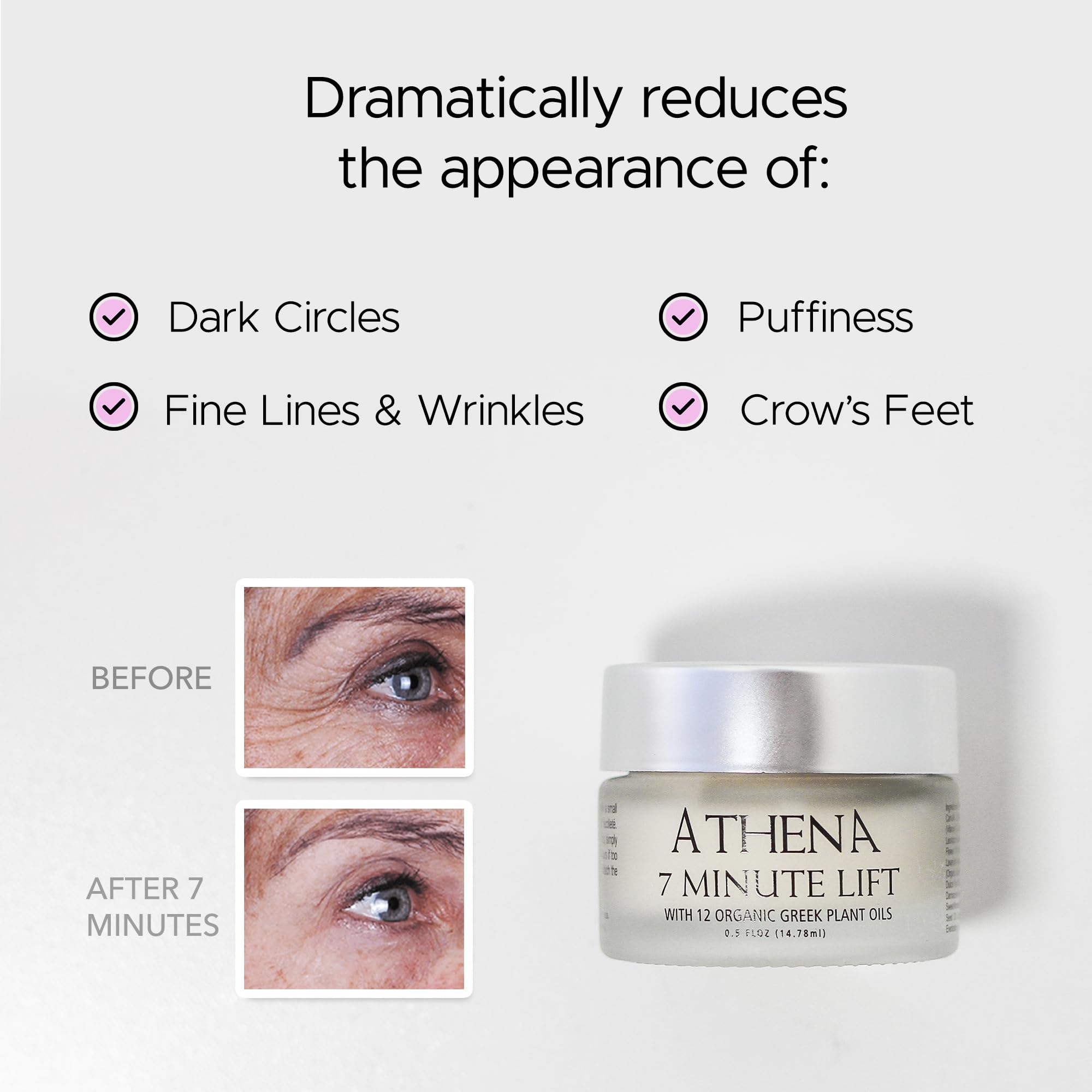 Athena 7 Minute Lift crow-feet area close-up shows potential line reduction.