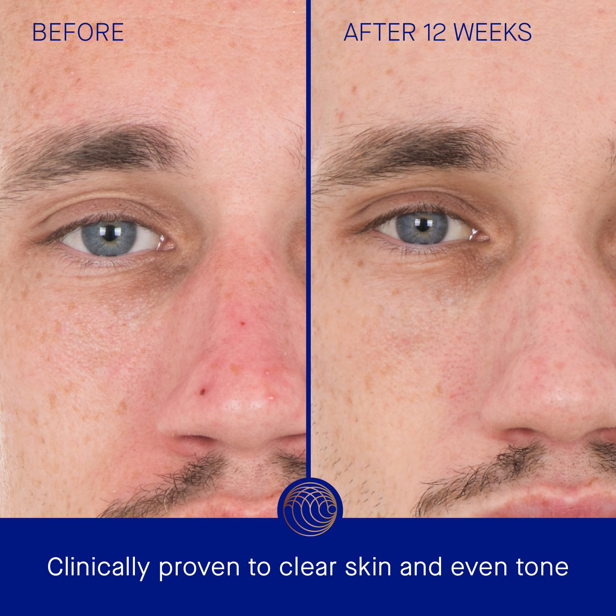 Augustinus Bader Retinol Serum outer box highlights luxury, science-backed skincare