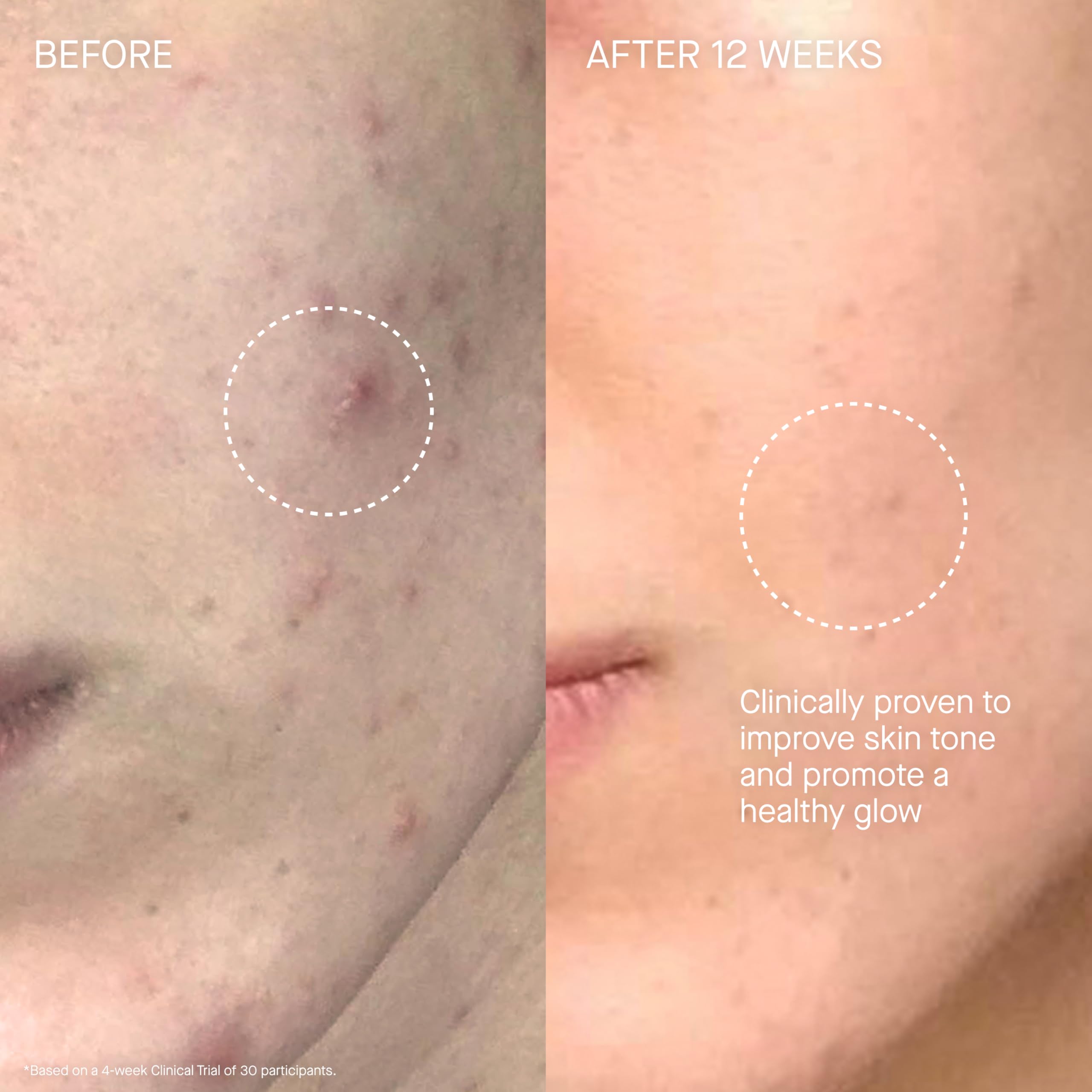 Augustinus Bader The Cream in a morning skincare routine for lasting moisture