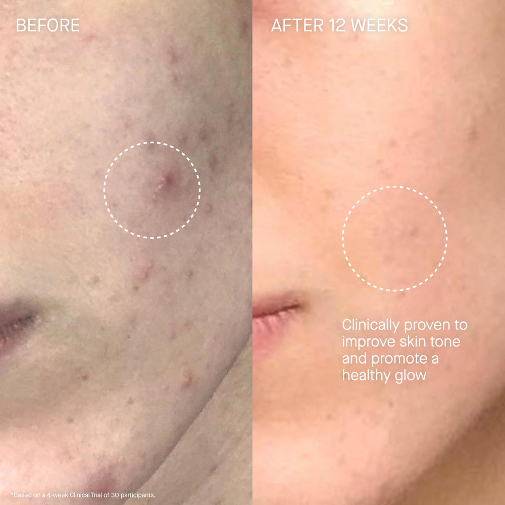 Augustinus Bader The Cream in a morning skincare routine for lasting moisture
