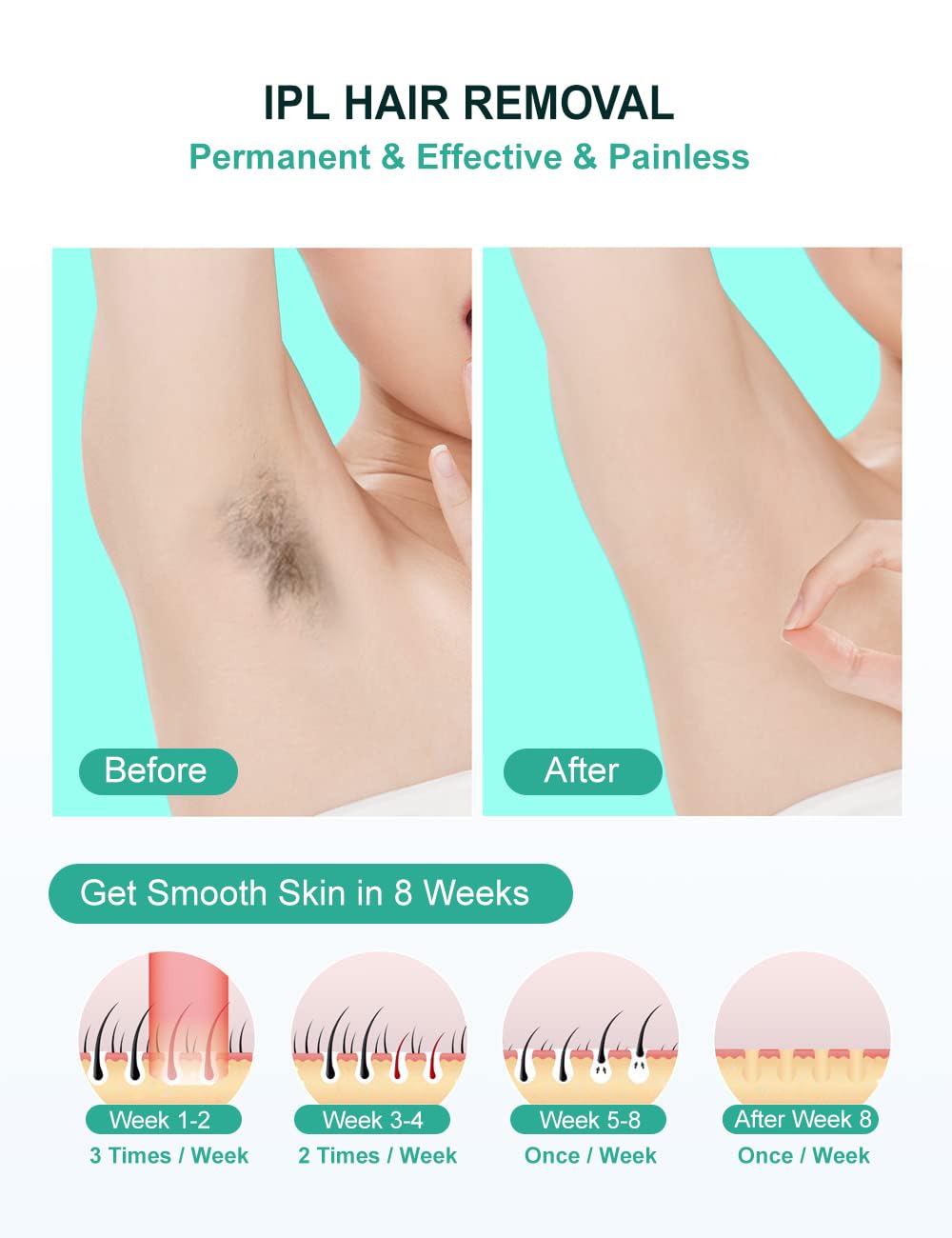 Painless at-home hair removal with AUITRONCARE device