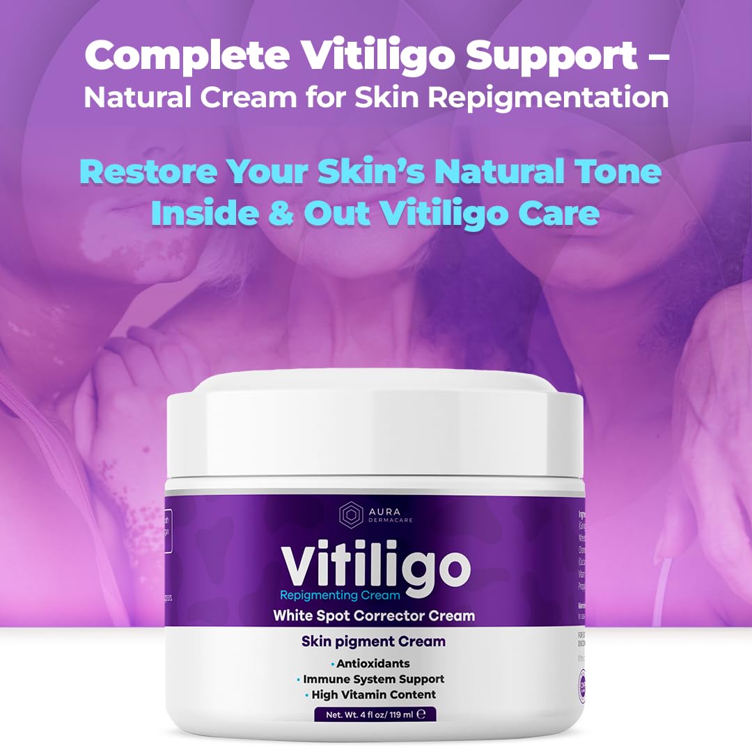 Aura Dermacare Vitiligo Cream on hand demonstrating quick absorption.