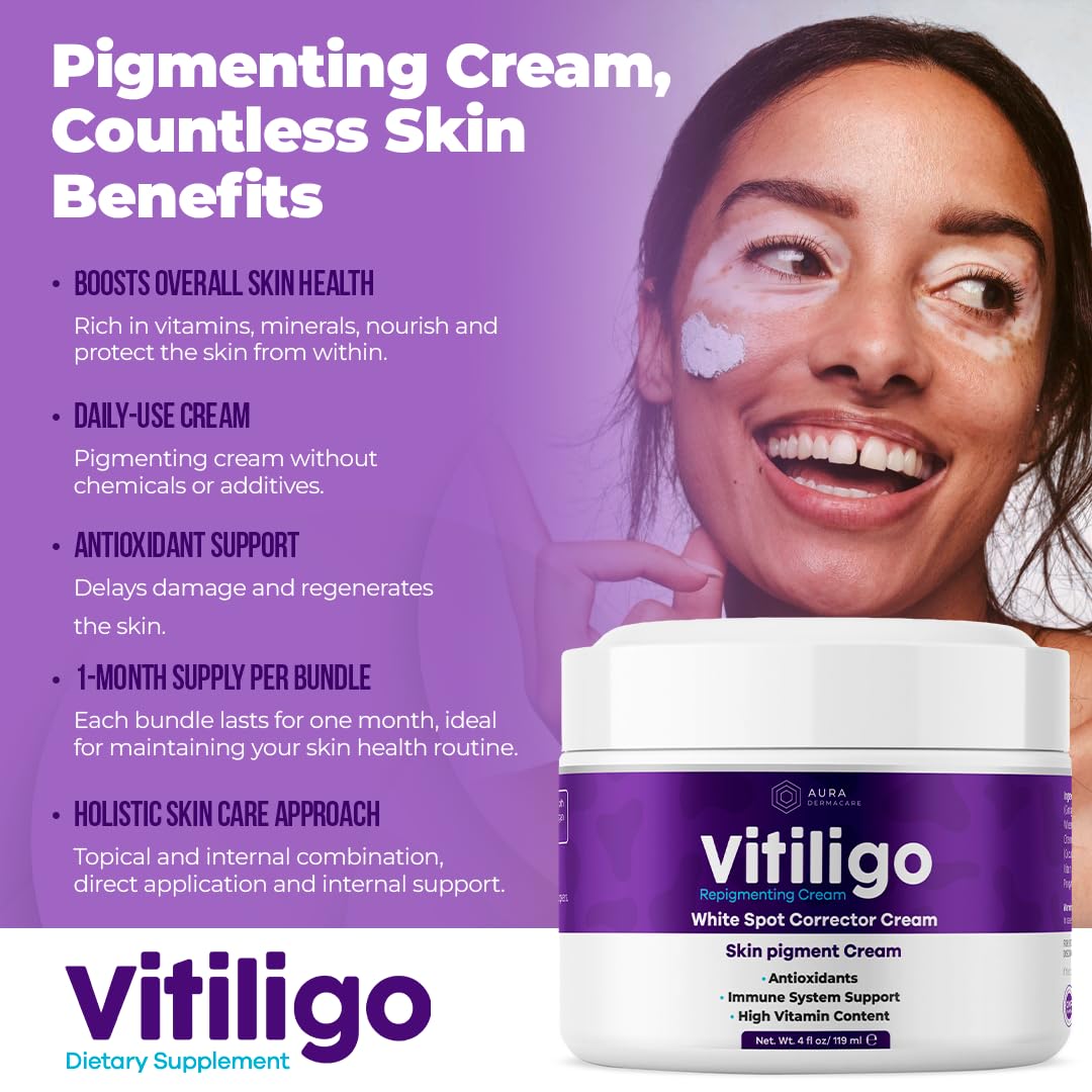 Aura Dermacare Vitiligo Cream being applied to skin for targeted care.